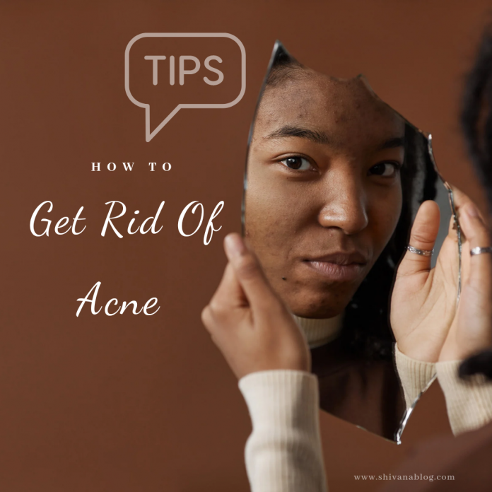 How To Get Rid Of Acne